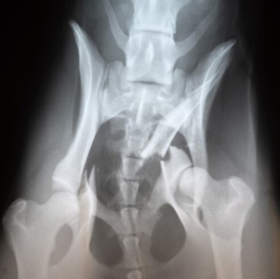 Dox x-ray of brocken hip